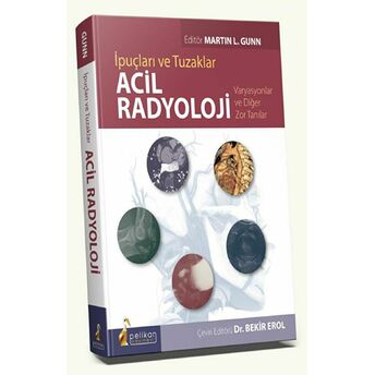 Acil Radyoloji Ciltli Bekir Erol