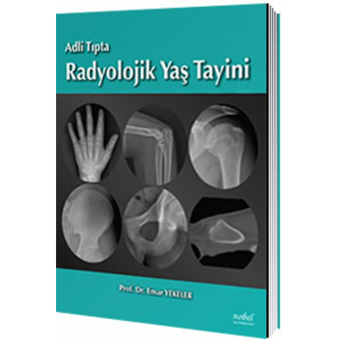 Adli Tıpta Radyolojik Yaş Tayini