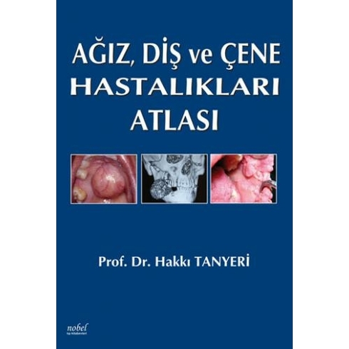 Ağız, Diş Ve Çene Hastalıkları Atlası