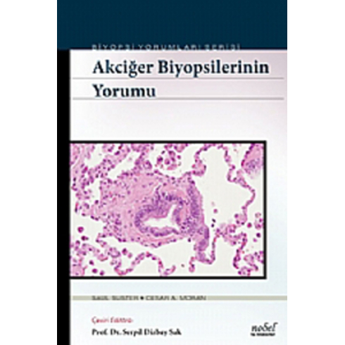 Akciğer Biyopsilerinin Yorumu - Biyopsi Yorumları Serisi - Serpil Dizbay