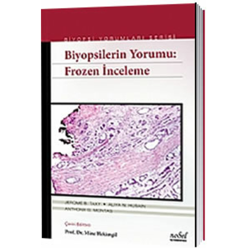 Biyopsilerin Yorumu: Frozen Inceleme