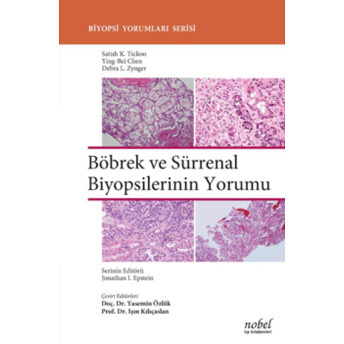 Böbrek Ve Sürrenal Biyopsilerinin Yorumu - Biyopsi Yorumları Serisi