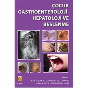 Çocuk Gastroenteroloji, Hepatoloji Ve Beslenme Aysel Yüce