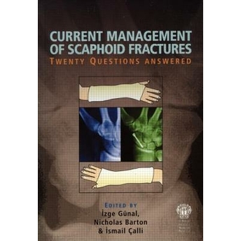 Current Management Of Scaphoid Fractures Izge Gunal