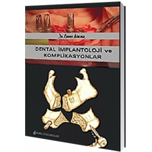 Dental Implantoloji Ve Komplikasyonlar