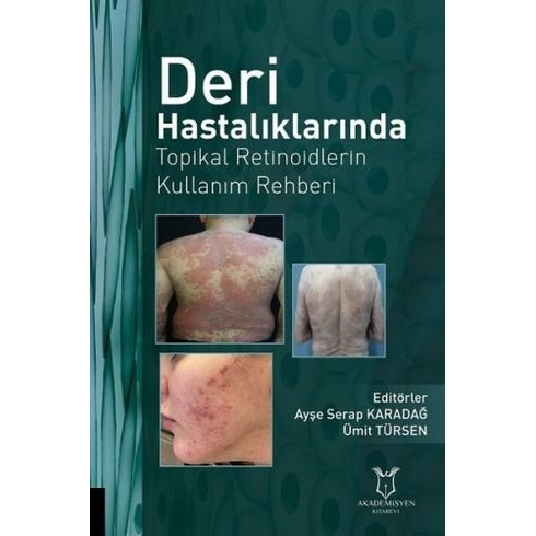 Deri Hastalıklarında Topikal Retinoidlerin Kullanım Rehberi - Ayşe Serap Karadağ