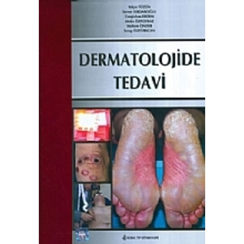 Dermatolojide Tedavi