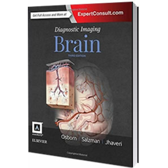 Diagnostic Imaging Brain Anne G. Osborn