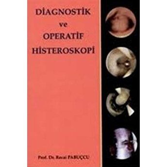 Diagnostik Ve Operatif Histeroskopi Ciltli Recai Pabucçu