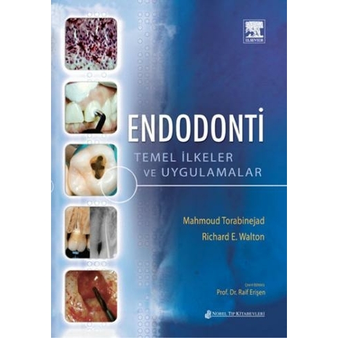 Endodonti Temel Ilkeler Ve Uygulamalar