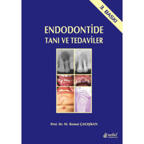 Endodontide Tanı Ve Tedaviler - M. Kemal Çalışkan