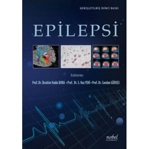 Epilepsi: Genişletilmiş Ikinci Baskı