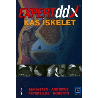 Expert Ddx Kas Iskelet Komisyon