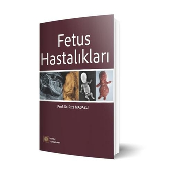 Fetus Hastalıkları Rıza Madazlı