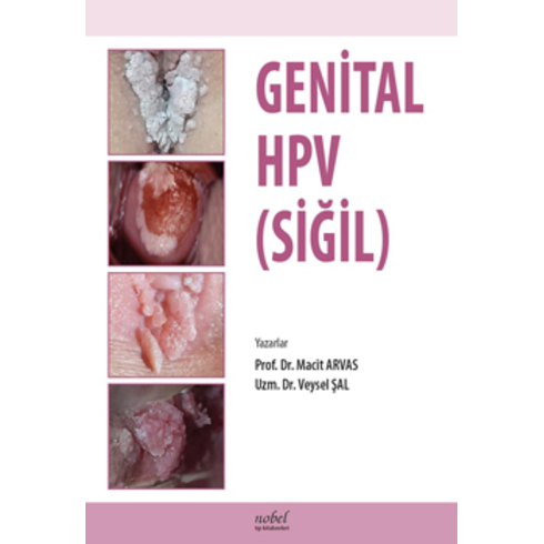 Genital Hpv Siğil