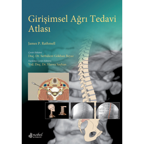 Girişimsel Ağrı Tedavi Atlası