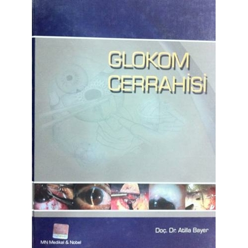 Glokom Cerrahisi