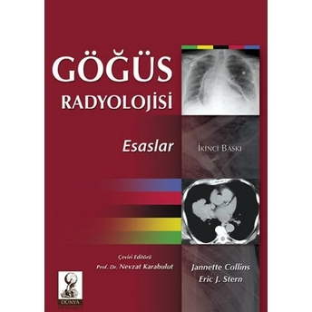 Göğüs Radyolojisi Esaslar Nevzat Karabulut