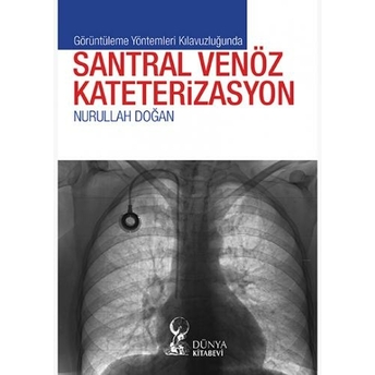 Görüntüleme Yöntemleri Kılavuzluğunda Santral Venöz Kateterizasyon Nurullah Doğan