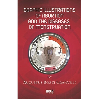 Graphic Illustratıons Of Abortıon And The Dıseases Of Menstruatıon - Augustus Bozzı Granvılle