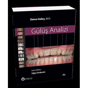 Gülüş Analizi Elaine Halley