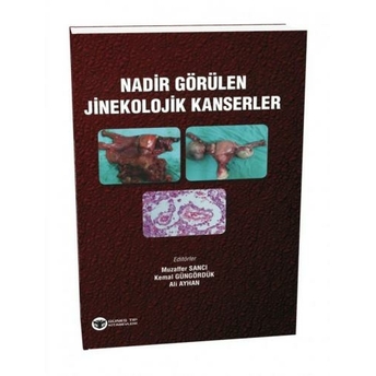 Güneş Tıp Nadir Görülen Jinekolojik Kanserler Ali Ayhan