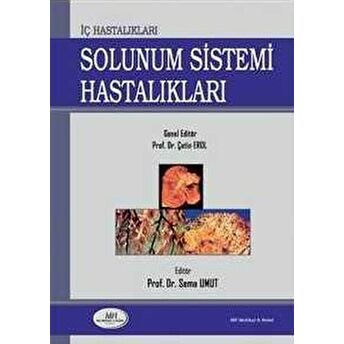 Iç Hastalıklar Solunum Sistemi Hastalıkları Sema Umut