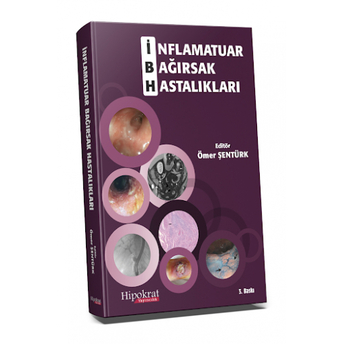 Inflamatuar Bağırsak Hastalıkları Ömer Şentürk