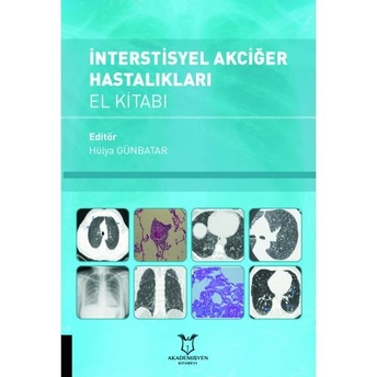 Interstisyel Akciğer Hastalıkları El Kitabı Hülya Günbatar