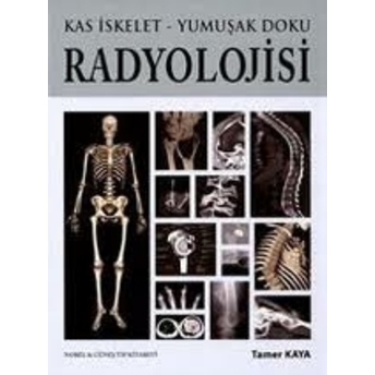 Kas Iskelet - Yumuşak Doku Radyolojisi – Tamer Kaya Tamer Kaya