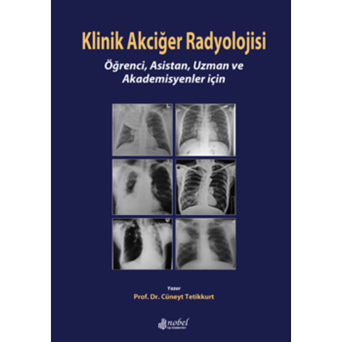 Klinik Akciğer Radyolojisi: Öğrenci, Asistan, Uzman Ve Akademisyenler Için