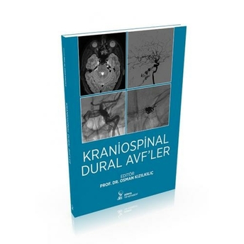 Kraniospinal Dural Avf’ler Osman Kızılkılıç