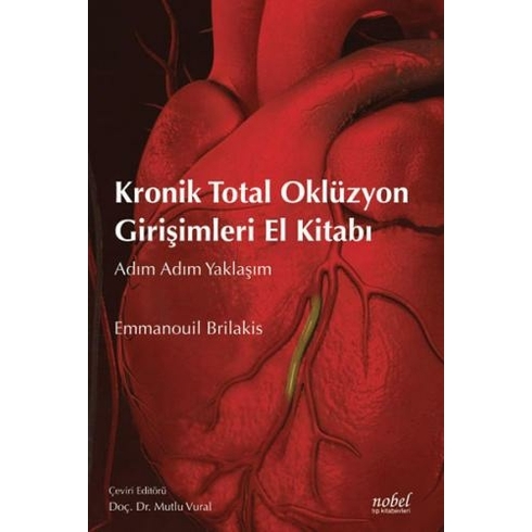 Kronik Total Oklüzyon Girişimleri El Kitabı: Adım Adım Yaklaşım