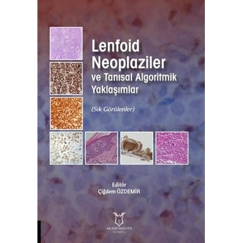 Lenfoid Neoplaziler Ve Tanısal Algoritmik Yaklaşımlar Çiğdem Özdemir