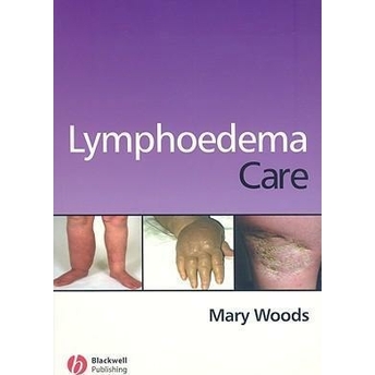 Lymphoedema Care Mary Elizabeth Woods