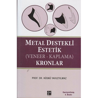 Metal Destekli Estetik (Veneer-Kaplama) Kronlar Hüsnü Yavuzyılmaz