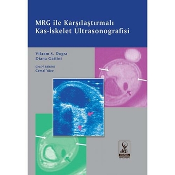 Mrg Ile Karşılaştırmalı Kas-Iskelet Ultrasonografisi Cemal Yüce