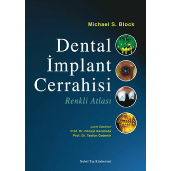 Nobel Tıp Dental Implant Cerrahisi Renkli Atlası - Cüneyt Karabuda,Tayfun Özdemir Cüneyt Karabuda