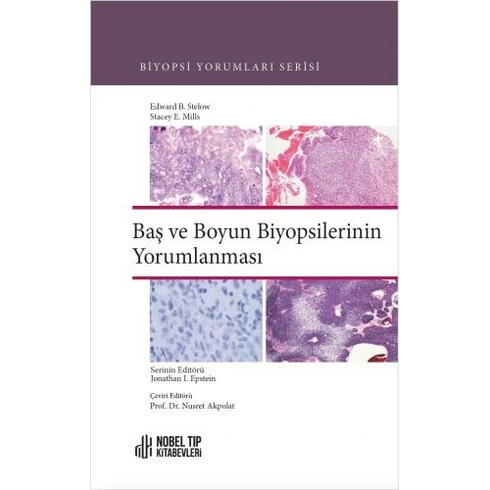 Nobel Tıp Kitabevi Baş Ve Boyun Biyopsilerinin Yorumlanması