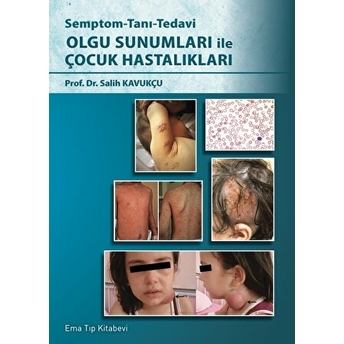 Olgu Sunumları Ile Çocuk Hastalıkları Salih Kavukçu