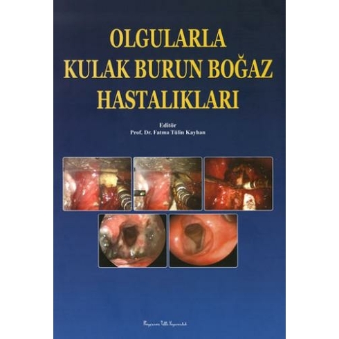 Olgularla Kulak Burun Boğaz Hastalıkları