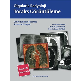 Olgularla Radyoloji Toraks Görüntüleme