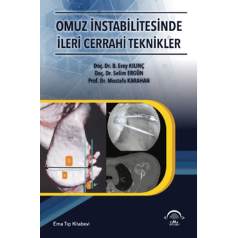 Omuz Intabilitesinde Ileri Cerrahi Teknikler Eray Kılınç