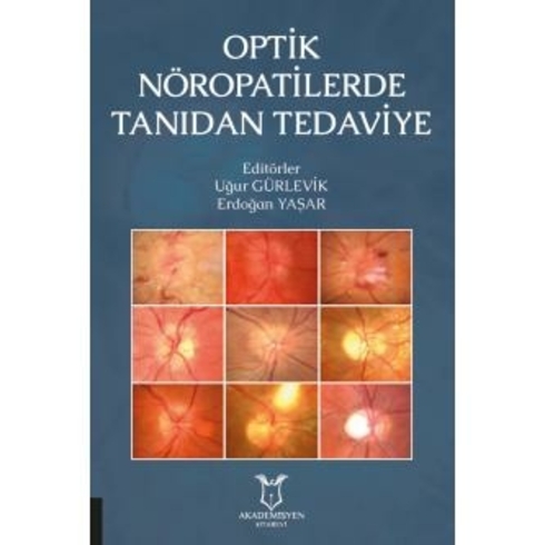 Optik Nöropatilerde Tanıdan Tedaviye - Uğur Gürlevik