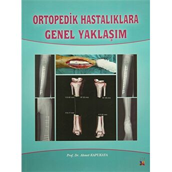 Ortopedik Hastalıklara Genel Yaklaşım Ahmet Kapukaya