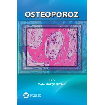 Osteoporoz Yeşim Gökçe Kutsal