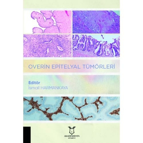 Overin Epitelyal Tümörleri - Ismail Harmankaya