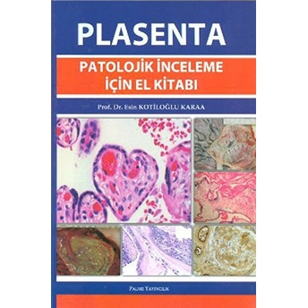 Plasenta Patolojik Inceleme Için El Kitabı