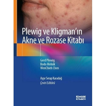 Plewig Ve Kligman'In Akne Ve Rozase Kitabı Gerd Plewing