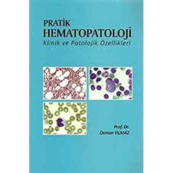 Pratik Hematopatoloji Klinik Ve Patolojik Özellikleri